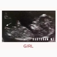 Ayuda con método ramzi: niño o niña? - 2