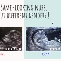 Ayuda con método ramzi: niño o niña? - 1