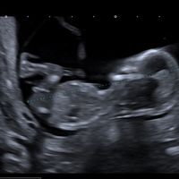 Niño o niña - 1