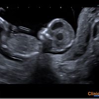 Niño o niña - 2