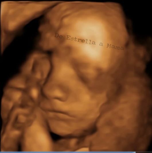 Mi bebe 28 semanas