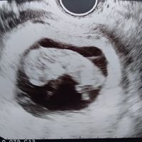 Mamis mayo 2020 - 1
