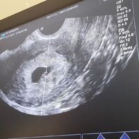  Futuras Mamis Julio 2018 - 1
