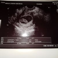 Buscadoras de sueños y milagros: IA, FIV, ICSI (Reproducción Asistida) - 1