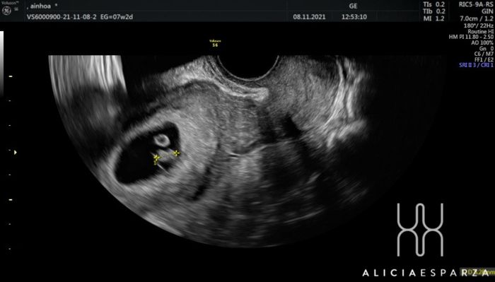 Futuras mamis Junio 2022!! 1