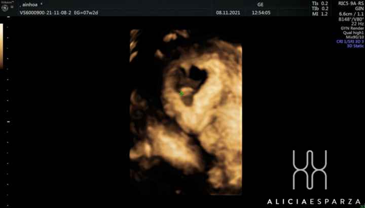 Futuras mamis Junio 2022!! - 2