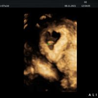 Futuras mamis Junio 2022!! - 2