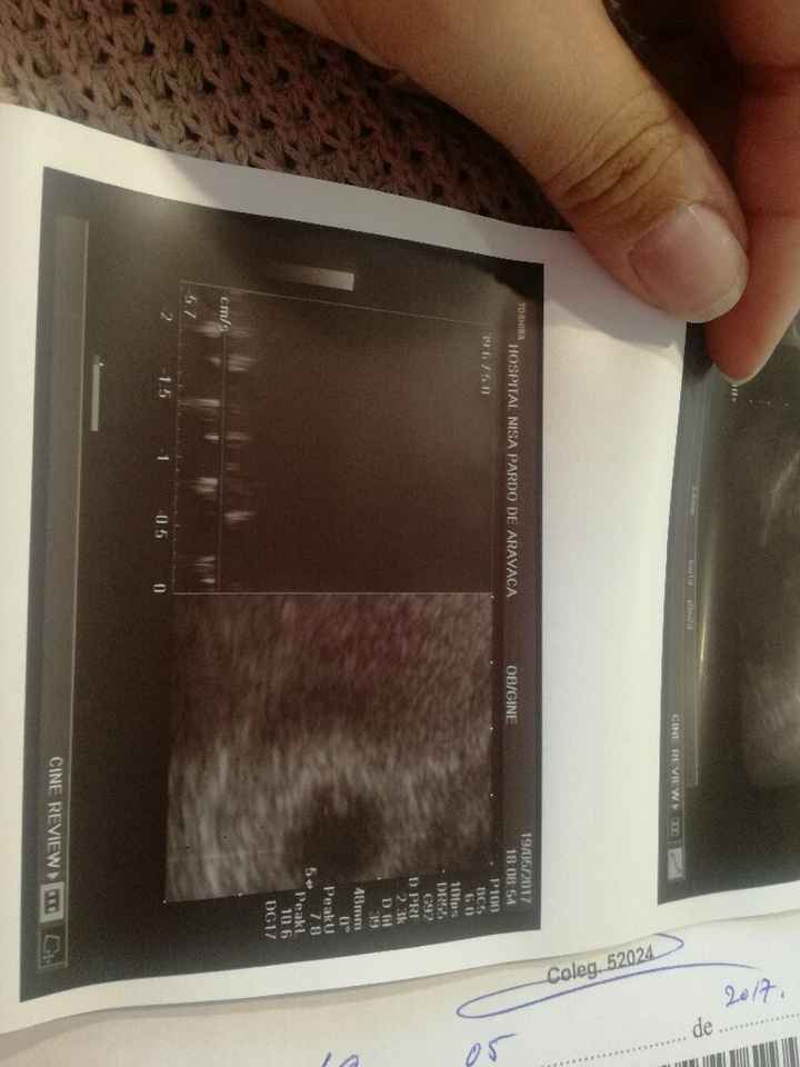 Futuras mamis enero 2018 - 1