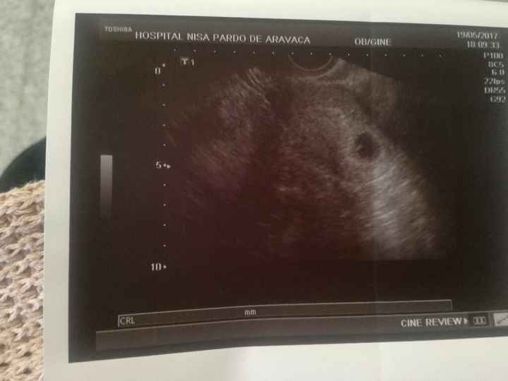 Futuras mamis enero 2018 - 2