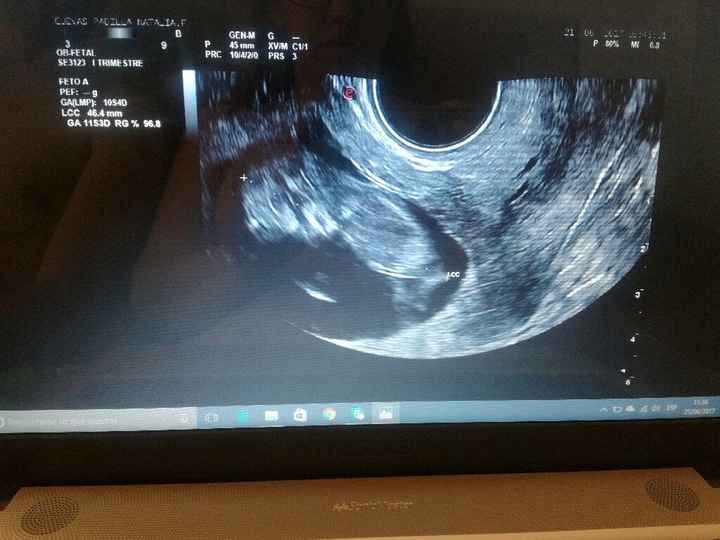 Futuras mamis enero 2018 - 1