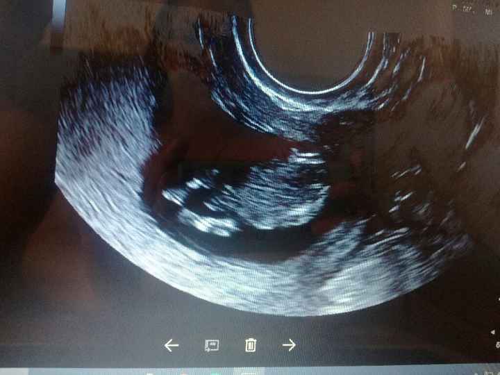 Futuras mamis enero 2018 - 2