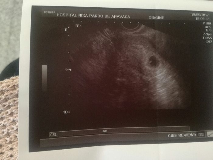 Futuras mamis enero 2018 - 2