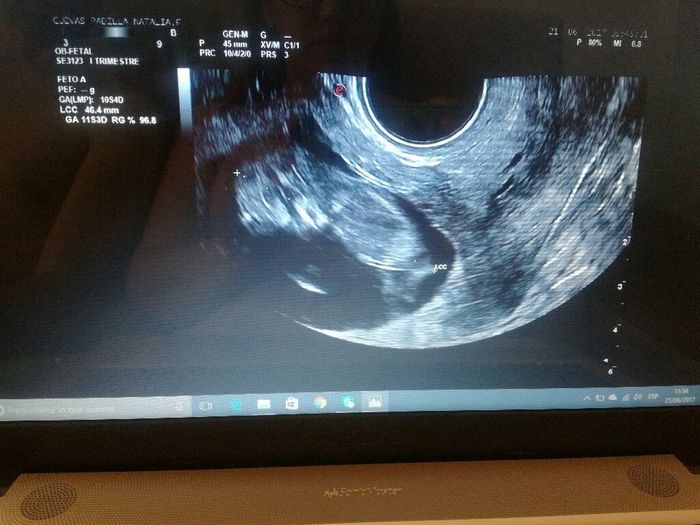 Futuras mamis enero 2018 - 1