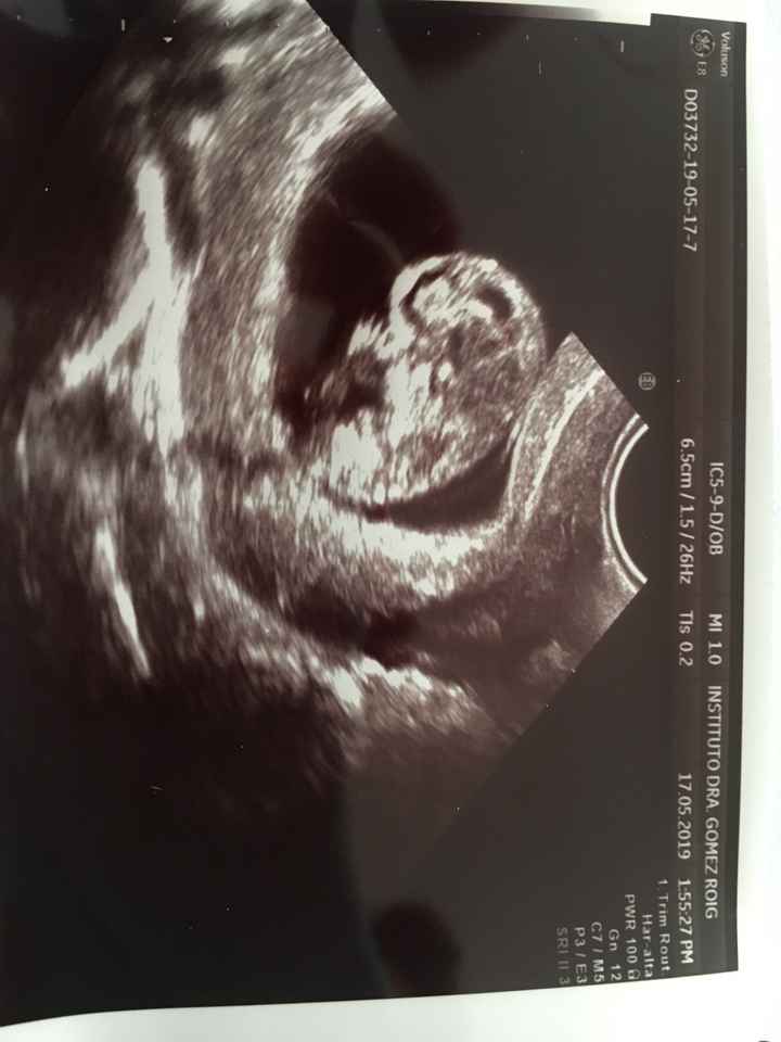 Futuras mamis diciembre 2019 oficial - 1