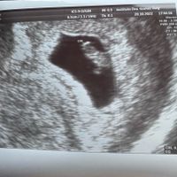 Futuras mamis Junio 2023 - 1