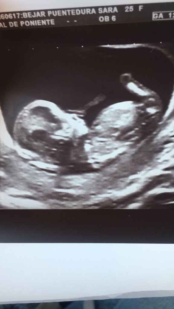 Futuras mamás marzo 2019 - 1