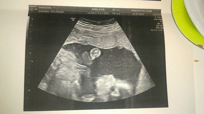 Buscadoras después de uno o varios abortos ii - 1