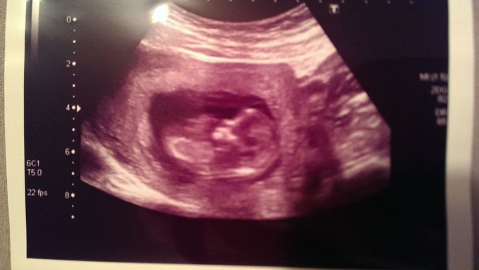 Mamas Abril 2015 - 1