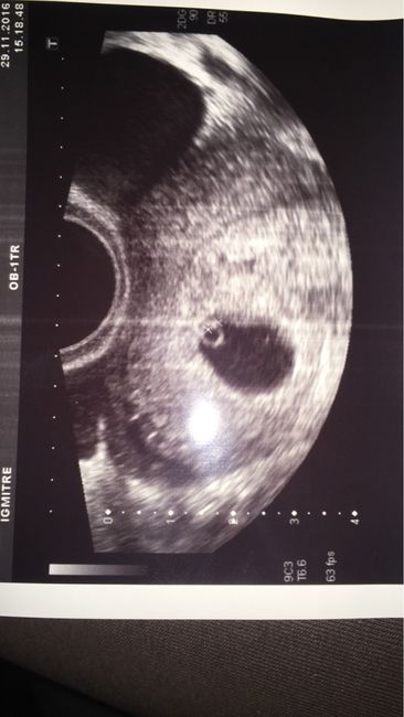 Mamis julio 2017 - 1