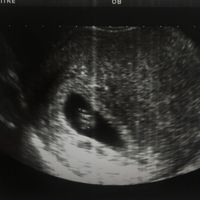 Mamis julio 2017 - 1
