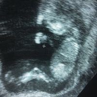 Mamis de junio 2017 - 1