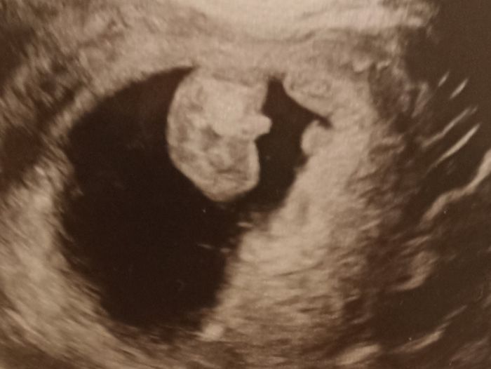 Futuras mamis Junio 2022!! 3