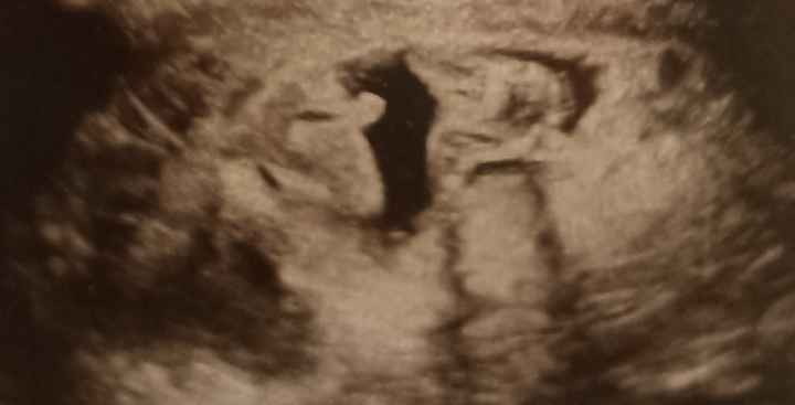 Futuras mamis Junio 2022!! - 1