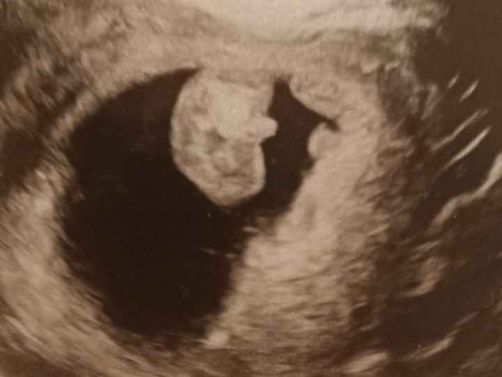 Futuras mamis Junio 2022!! - 2