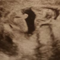 Futuras mamis Junio 2022!! - 1
