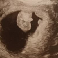 Futuras mamis Junio 2022!! - 2