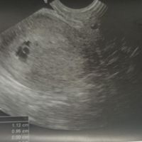 Futuras mamis Enero 2022 - 1