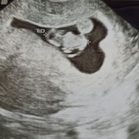 Futuras mamis Enero 2022 - 2