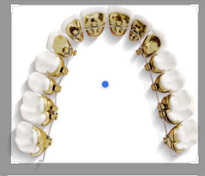 Dilema existencial: ortodoncia - 1