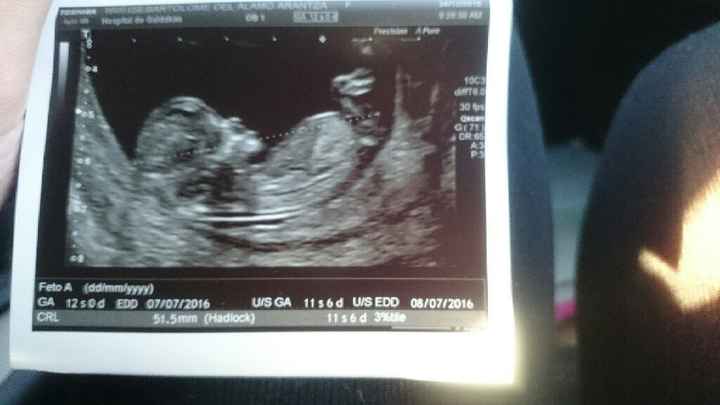 Futuras mamas julio 2016 - 1