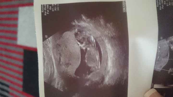 Futuras mamas julio 2016 - 1