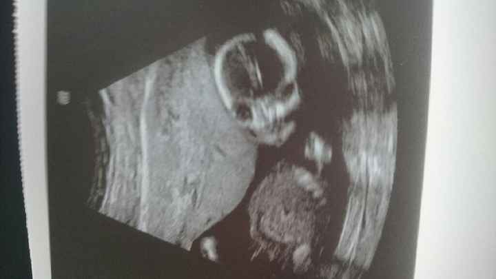 Futuras mamas julio 2016 - 1