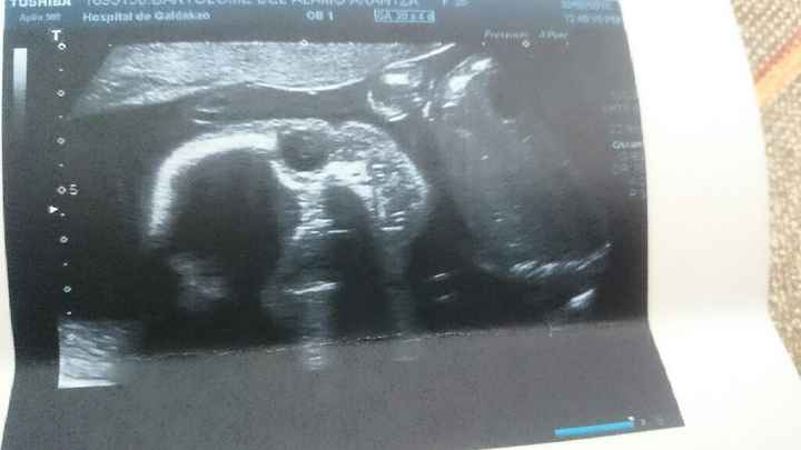 Futuras mamas julio 2016 - 2