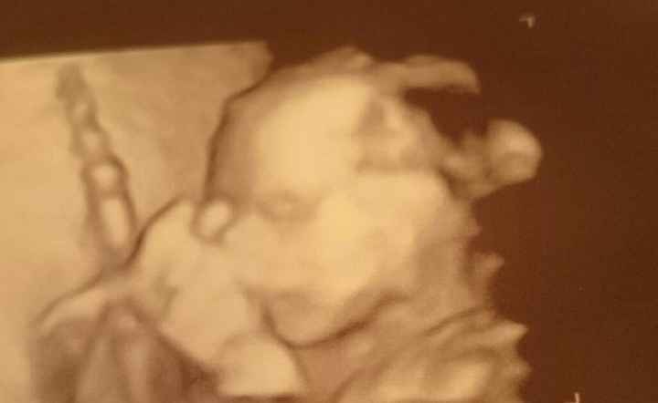 Futuras mamas julio 2016 - 1