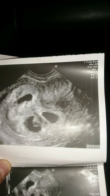 Futuras mamas julio 2016 - 1
