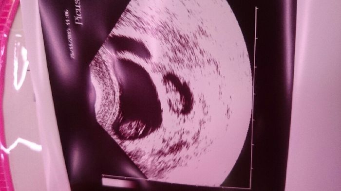 Futuras mamas julio 2016 - 1