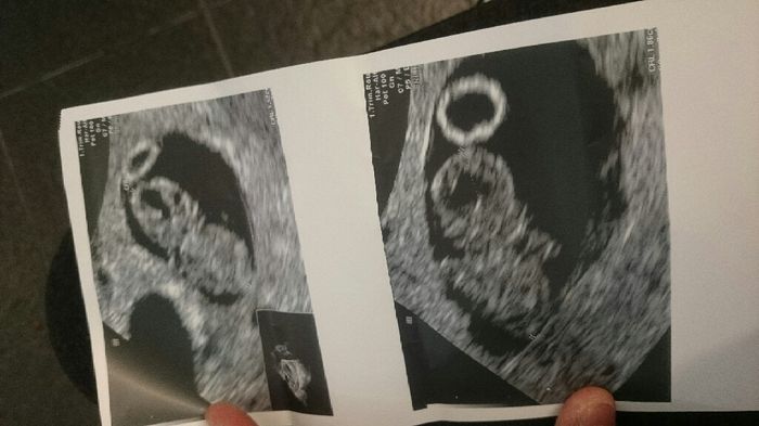 Futuras mamas julio 2016 - 1