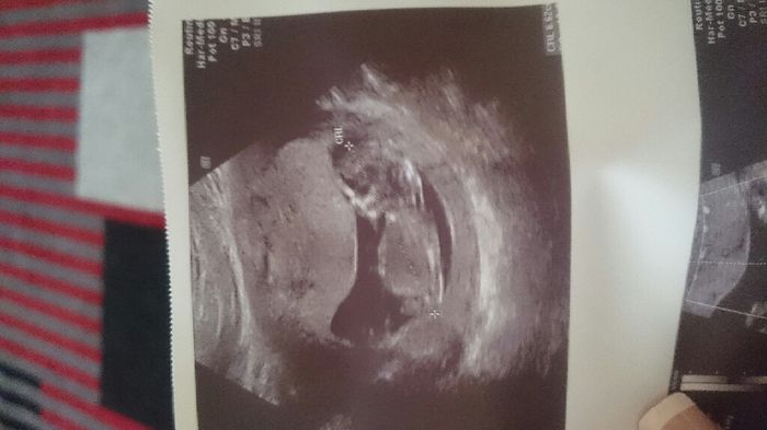 Futuras mamas julio 2016 - 1