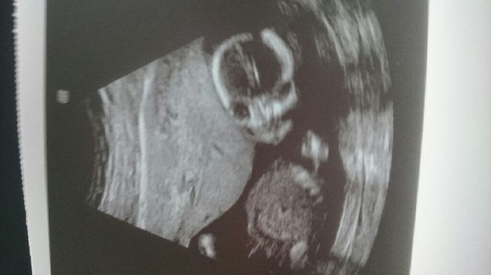 Futuras mamas julio 2016 - 1