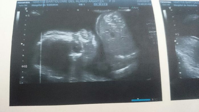 Futuras mamas julio 2016 - 1
