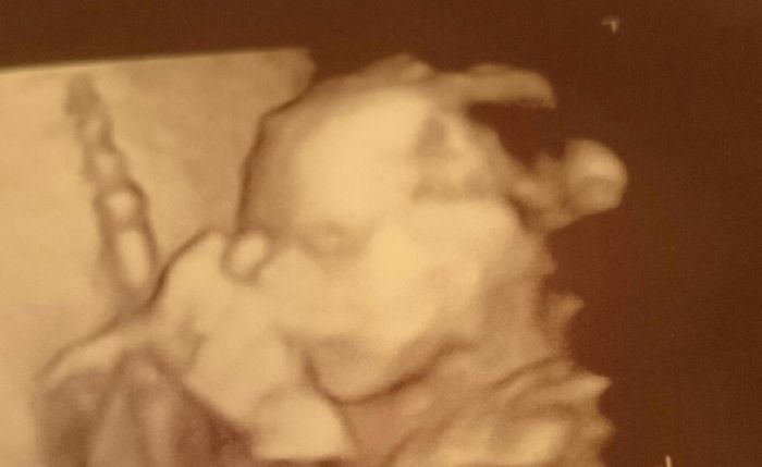 Futuras mamas julio 2016 - 1