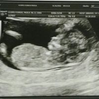Futuras mamás abril 2017 - 1