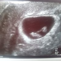 Ayuda con método ramzi: niño o niña? - 2