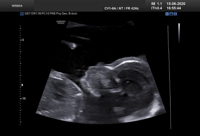 Futuras mamas octubre 2020 - 1