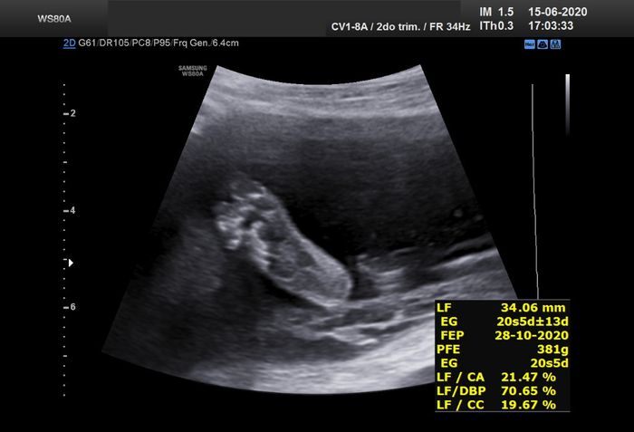 Futuras mamas octubre 2020 - 2