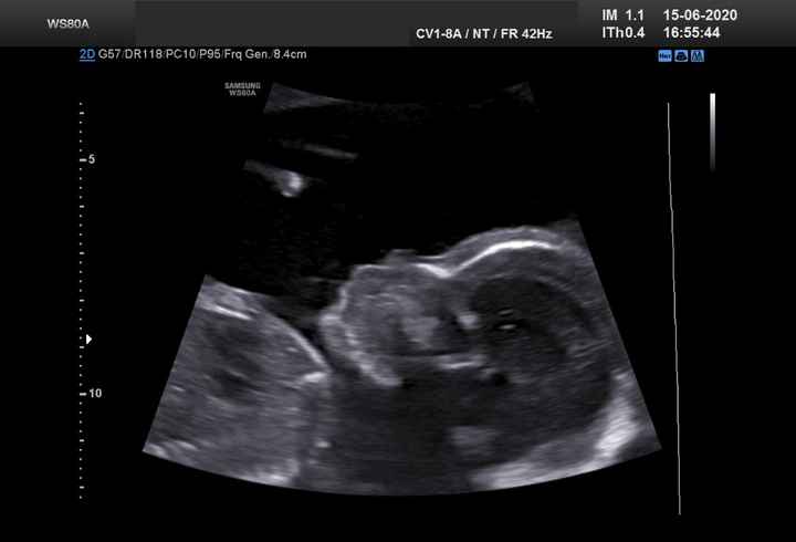 Futuras mamas octubre 2020 - 1